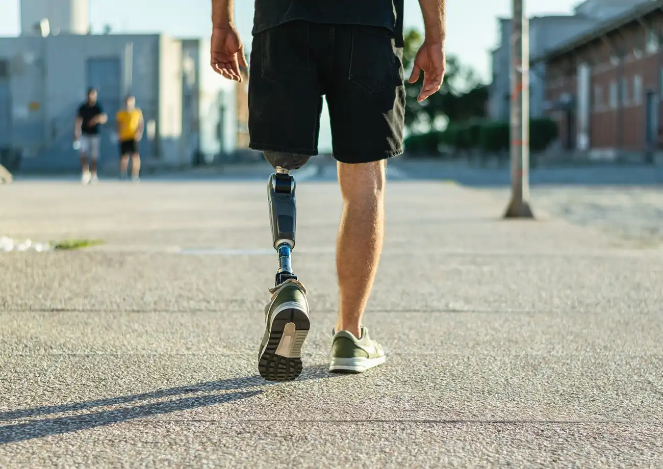 Prosthetic Care Tips | Daily Maintenance & Limb Health