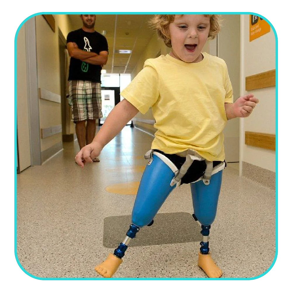 Pediatric Prostheses in Las Vegas, Nevada Limb & Brace