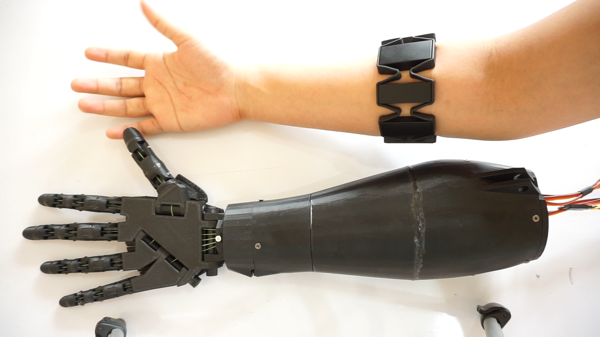 Myoelectric Prostheses in Las Vegas