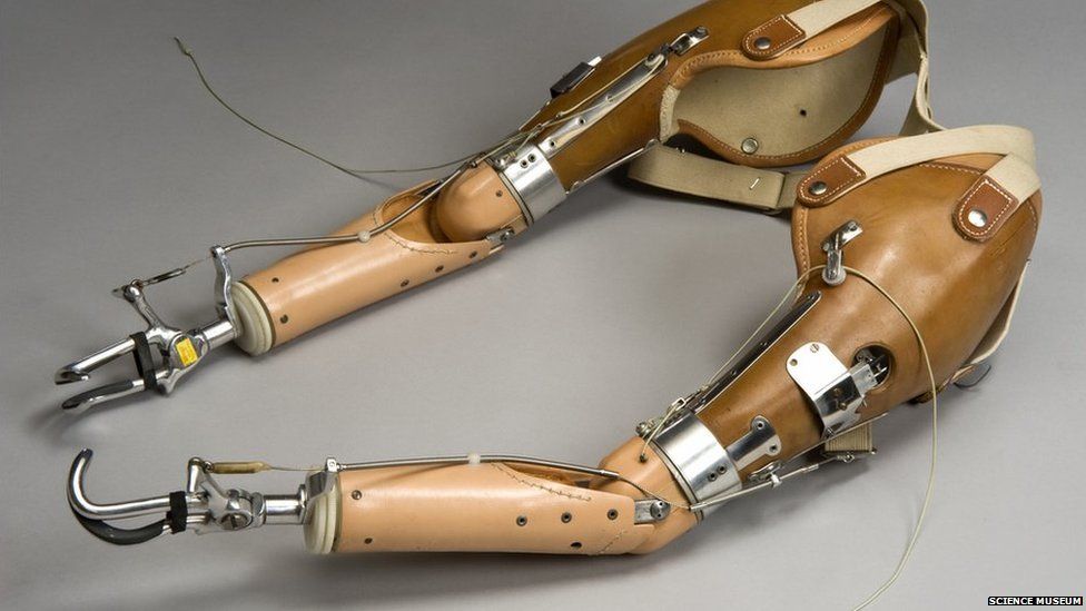 Upper & Lower Limb Prostheses in Las Vegas, NV LAB
