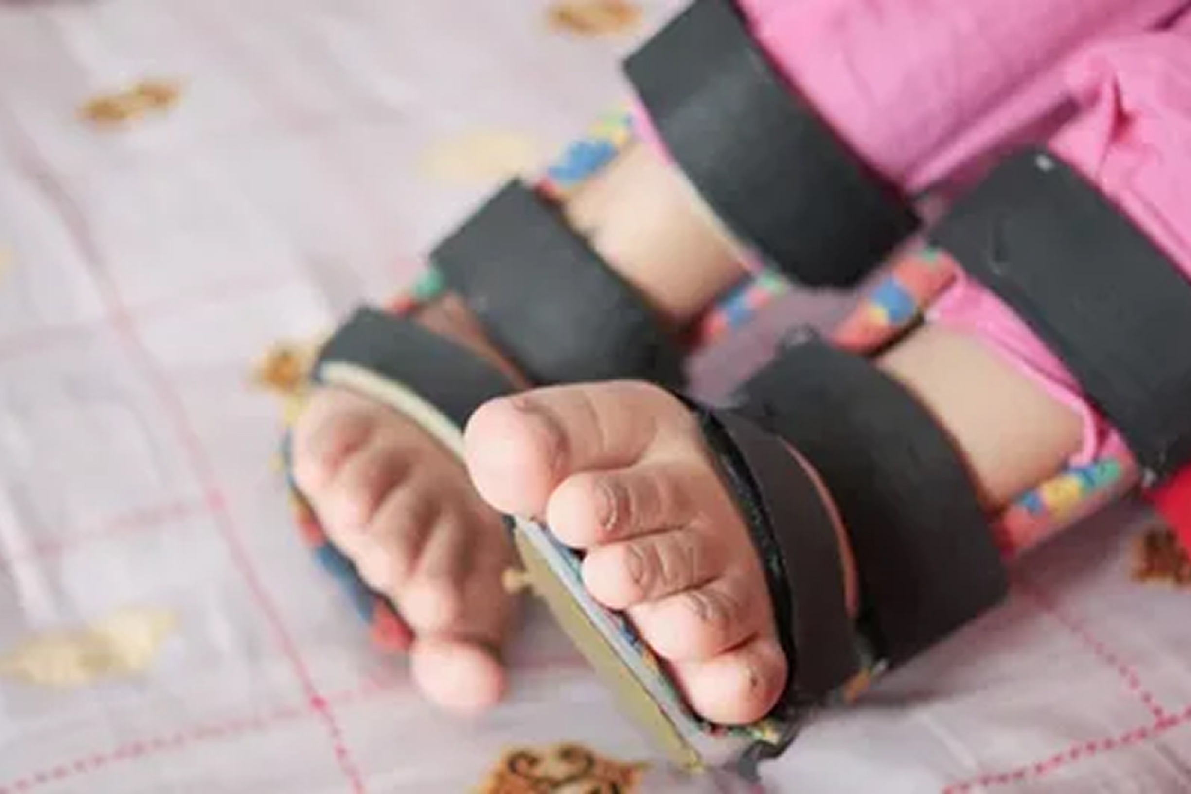 Pediatric Orthotics in Las Vegas, Custom Braces for Children